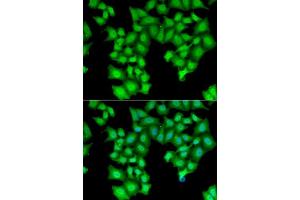 Immunofluorescence analysis of HeLa cells using CPSF3L antibody. (CPSF3L Antikörper  (AA 331-600))