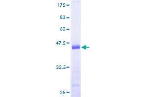 HSPB7 Protein (AA 1-170) (GST tag)