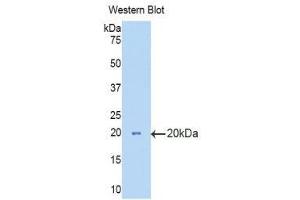 Western Blotting (WB) image for anti-Hexosaminidase B (Beta Polypeptide) (HEXB) (AA 294-435) antibody (ABIN3208192) (HEXB Antikörper  (AA 294-435))