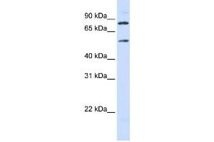 Western Blotting (WB) image for anti-Solute Carrier Family 27 (Fatty Acid Transporter), Member 4 (SLC27A4) antibody (ABIN2458790) (SLC27A4 Antikörper)