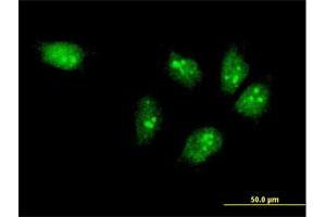 Immunofluorescence of monoclonal antibody to MTA3 on HeLa cell. (MTA3 Antikörper  (AA 416-515))