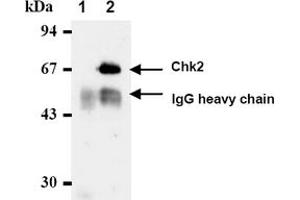 Western Blotting (WB) image for anti-Checkpoint Kinase 2 (CHEK2) antibody (ABIN487312) (CHEK2 Antikörper)