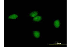 Immunofluorescence of purified MaxPab antibody to FLJ35220 on HeLa cell.