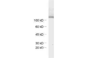 dilution: 1 : 1000, sample: mouse retina extract (Ribeye (AA 95-207) Antikörper)