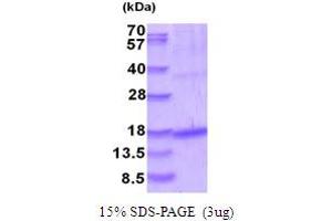 GDF5 Protein (AA 376-495) (His tag)