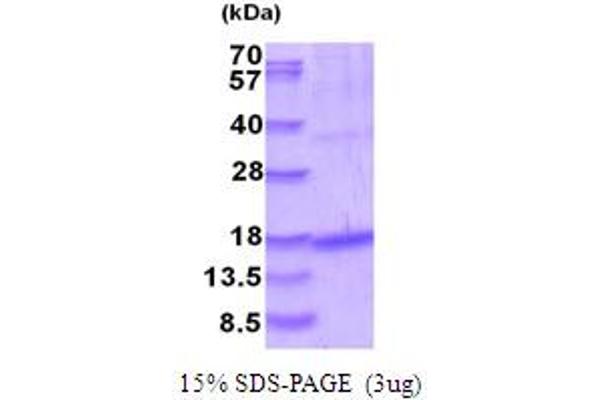 GDF5 Protein (AA 376-495) (His tag)