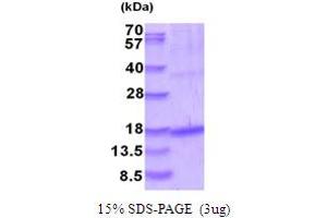 SDS-PAGE (SDS) image for Growth Differentiation Factor 5 (GDF5) (AA 376-495) protein (His tag) (ABIN5853985)