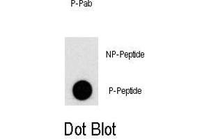 Dot blot analysis of Phospho-PI3KC3- Antibody (ABIN389757 and ABIN2839683) on nitrocellulose membrane.