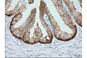 Immunohistochemical staining of paraffin-embedded Human prostate tissue using anti-CRYM mouse monoclonal antibody. (CRYM Antikörper)
