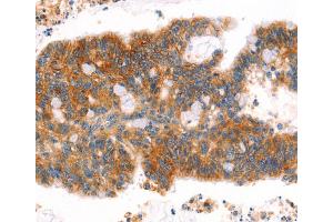 Immunohistochemistry (IHC) image for anti-Afadin (MLLT4) antibody (ABIN2432053)