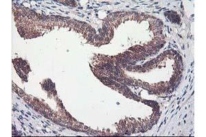 Image no. 1 for anti-Chromosome X Open Reading Frame 26 (CXorf26) antibody (ABIN1497690) (CXorf26 Antikörper)