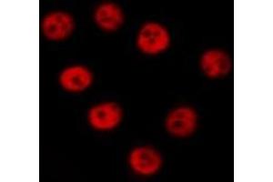 ABIN6277272 staining  NIH-3T3 cells by IF/ICC. (Mre11 Antikörper  (C-Term))