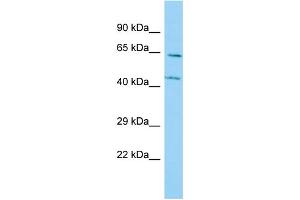 Host: Rabbit Target Name: P4HA3 Sample Type: A549 Whole Cell lysates Antibody Dilution: 1. (P4HA3 Antikörper  (N-Term))
