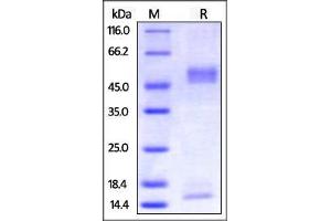 Biotinylated Mouse FcRn / FCGRT & B2M on SDS-PAGE under reducing (R) condition. (FcRn Protein (AA 22-297) (His tag,Strep Tag,AVI tag,Biotin))