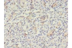 Immunohistochemistry of paraffin-embedded human pancreatic tissue using ABIN7175650 at dilution of 1:100 (VWA5B2 Antikörper  (AA 781-862))