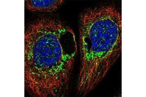 Immunofluorescent staining of human cell line A-431 with DAP polyclonal antibody  shows positivity in mitochondria. (DAP Antikörper)