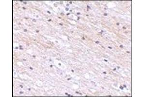 Immunohistochemistry of SATB1 in human brain tissue with this product at 2. (SATB1 Antikörper  (N-Term))