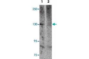 Western blot analysis of NLRP5 in mouse brain tissue lysate with NLRP5 polyclonal antibody  at 1 ug/mL in (1) the absence and (2) the presence of blocking peptide. (NLRP5 Antikörper  (C-Term))
