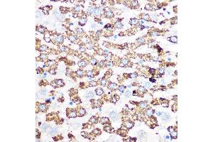Immunohistochemistry of paraffin-embedded rat liver using GLUD1 Rabbit mAb (ABIN7267411) at dilution of 1:100 (40x lens).