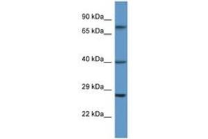 Image no. 1 for anti-Angiotensin II Receptor, Type 2 (AGTR2) (N-Term) antibody (ABIN6746732) (Angiotensin II Type 2 Receptor Antikörper  (N-Term))