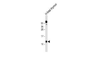 Anti-AHSP Antibody (Center) at 1:1000 dilution + human fetal thymus lysate Lysates/proteins at 20 μg per lane. (aHSP Antikörper  (AA 39-73))