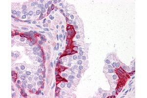 Anti-PIAS3 antibody IHC of human prostate. (PIAS3 Antikörper  (C-Term))