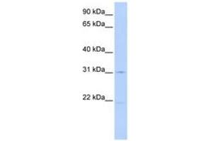 Image no. 1 for anti-Solute Carrier Family 25 (Mitochondrial Oxodicarboxylate Carrier), Member 21 (Slc25a21) (AA 72-121) antibody (ABIN6740856) (SLC25A21 Antikörper  (AA 72-121))