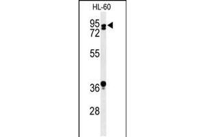 Western blot analysis of PATL1 Antibody in HL-60 cell line lysates (35ug/lane) (PATL1 Antikörper  (C-Term))