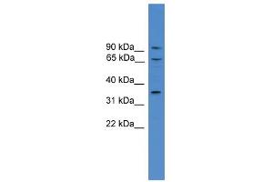 WB Suggested Anti-CCIN Antibody Titration: 0. (Calicin Antikörper  (N-Term))