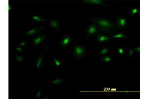 Immunofluorescence of monoclonal antibody to NEK2 on HeLa cell.