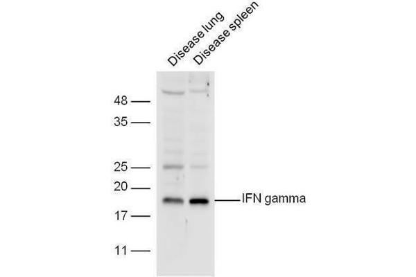 Interferon gamma Antikörper  (AA 75-155)