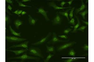 Immunofluorescence of monoclonal antibody to CUL4A on HeLa cell. (Cullin 4A Antikörper  (AA 1-100))