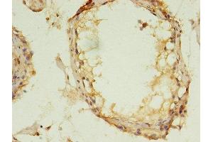 Immunohistochemistry (IHC) image for anti-Mitogen-Activated Protein Kinase 13 (MAPK13) (AA 1-365) antibody (ABIN7159988)