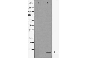 Western blot analysis of Interleukin 8 expression in HeLa cells,,The lane on the left is treated with the antigen-specific peptide. (IL-8 Antikörper  (Internal Region))