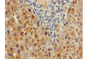 Immunohistochemistry of paraffin-embedded human liver tissue using ABIN7171273 at dilution of 1:100 (SDCBP Antikörper  (AA 21-228))