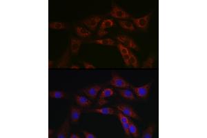 Immunofluorescence analysis of NIH/3T3 cells using  Rabbit pAb (ABIN6129847, ABIN6136332, ABIN6136333 and ABIN6223063) at dilution of 1:100 (40x lens). (ABCA1 Antikörper  (AA 1870-2120))