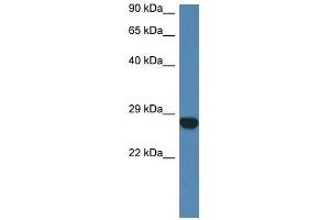 Western Blot showing Ccdc90b antibody used at a concentration of 1. (CCDC90B Antikörper  (N-Term))