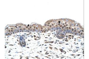 Immunohistochemistry (IHC) image for anti-Interferon Regulatory Factor 4 (IRF4) (N-Term) antibody (ABIN2780428)