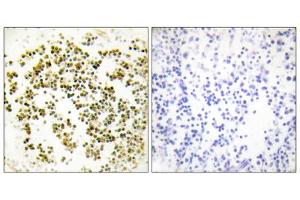 Immunohistochemistry analysis of paraffin-embedded human lymph node tissue using Musculin antibody. (Musculin Antikörper  (C-Term))