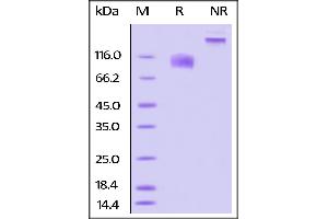 SDS-PAGE (SDS) image for Interleukin 17 Receptor A (IL17RA) (AA 33-320) (Active) protein (Fc Tag,AVI tag,Biotin) (ABIN4949028)
