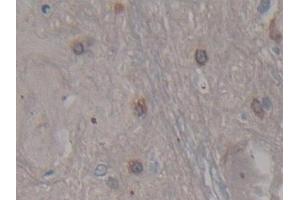 Detection of CDNF in Rat Spinal cord Tissue using Polyclonal Antibody to Cerebral Dopamine Neurotrophic Factor (CDNF) (CDNF Antikörper  (AA 20-183))