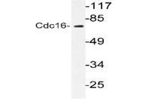 Western blot analysis of CDC16 in extracts from HuvEc cells using CDC16 / APC6 antibody (CDC16 Antikörper)