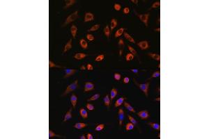 Immunofluorescence analysis of L929 cells using TP53I13 antibody (ABIN7271098) at dilution of 1:100.
