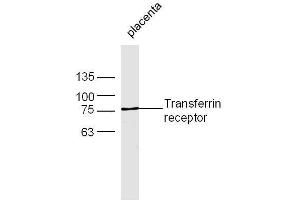 Mouse placenta lysates probed with Rabbit Anti-Transferrin receptor Polyclonal Antibody, Unconjugated  at 1:500 for 90 min at 37˚C (Transferrin Receptor Antikörper  (AA 621-720))
