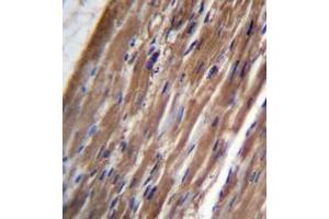 Immunohistochemistry analysis in formalin fixed and paraffin embedded human heart tissue reacted with FBLIM1 Antibody (C-term) followed by peroxidase conjugation of the secondary antibody and DAB staining.