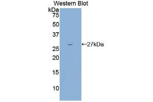 Western blot analysis of the recombinant protein. (IL2 Receptor beta Antikörper  (AA 27-239))