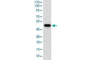 Western blot analysis of human TUBE1 (AA: 314-472) recombinant protein (Expected MW is 44. (TUBE1 Antikörper  (AA 314-472))