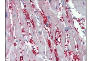 Human Heart: Formalin-Fixed, Paraffin-Embedded (FFPE) (alpha 1 Adrenergic Receptor Antikörper  (AA 206-270))