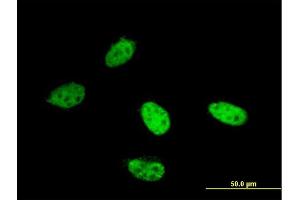 Immunofluorescence of monoclonal antibody to AOF2 on HeLa cell.