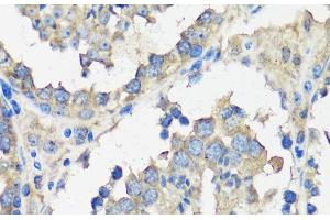 Immunohistochemistry of paraffin-embedded Mouse testis using ASZ1 Polyclonal Antibody at dilution of 1:100 (40x lens). (ASZ1 Antikörper)